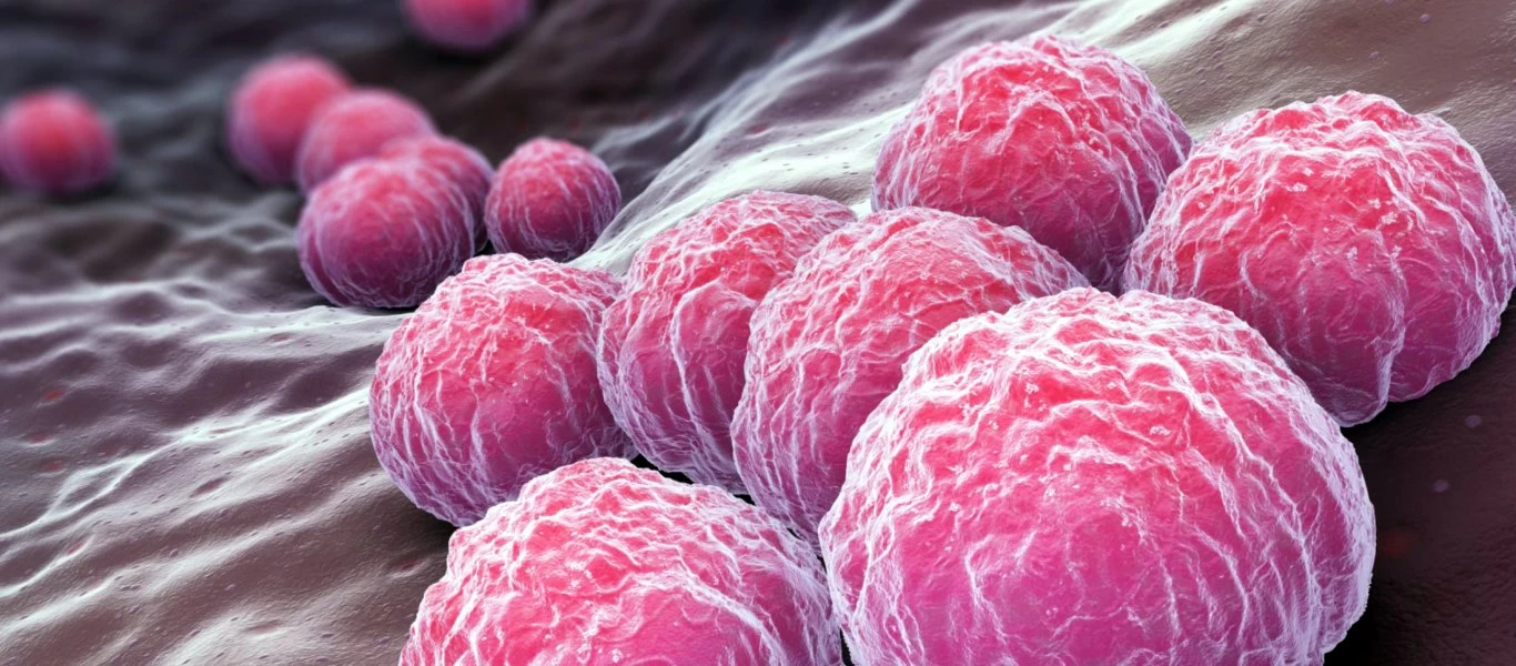 Προσοχή: Αν εντοπίσετε αυτά τα σημάδια τότε έχετε χλαμύδια